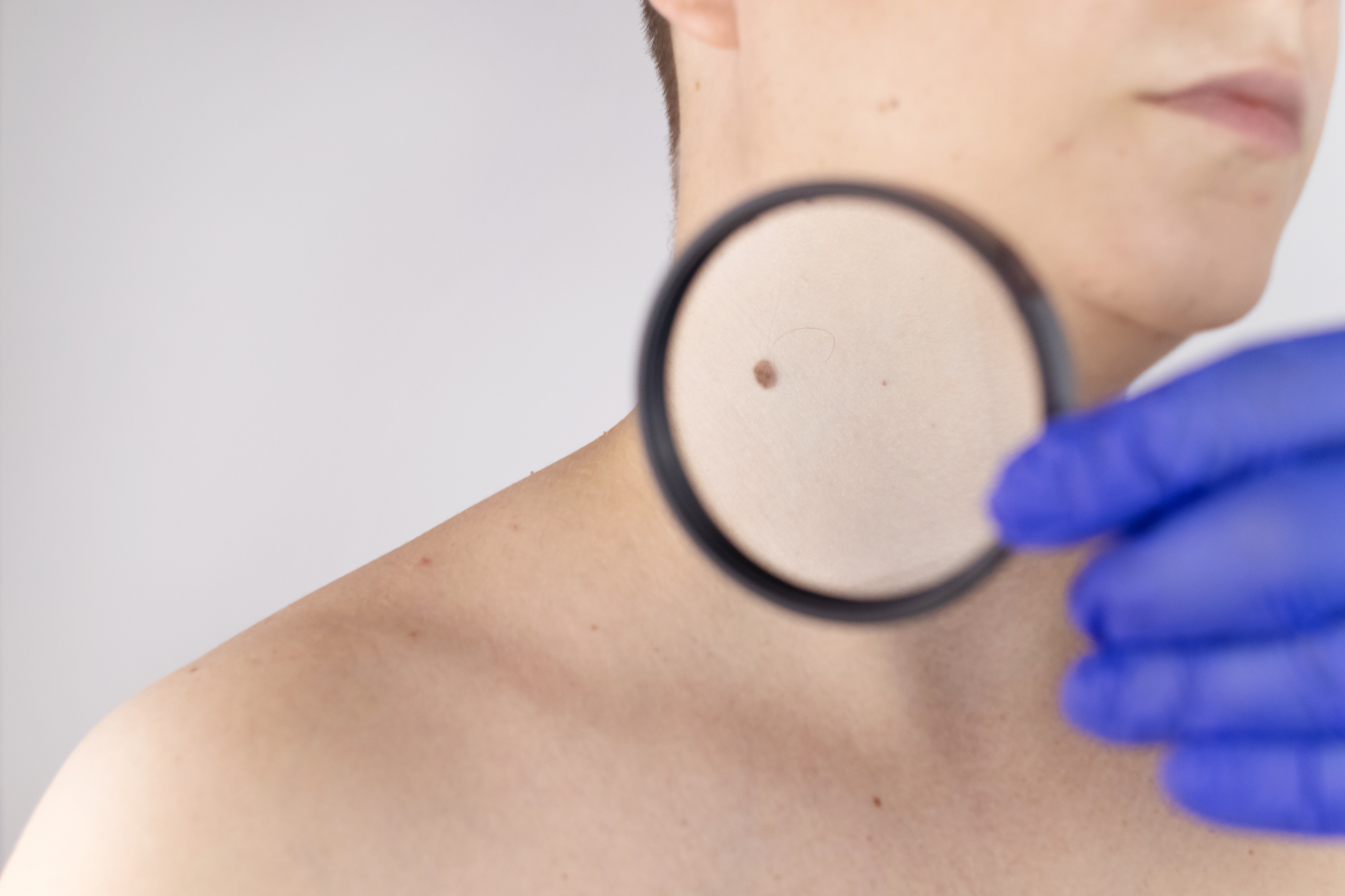 Obisk v dermatologija Ljubljana mi je ostal v lepem spominu